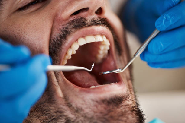 Best Mobile Emergency Dentist in Jackson, CA